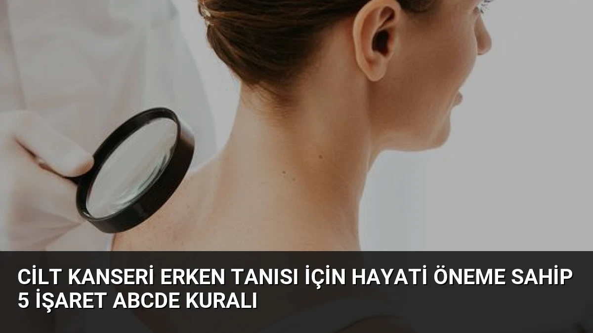 Cilt Kanseri Erken Tanısı İçin Hayati Öneme Sahip 5 İşaret ABCDE Kuralı