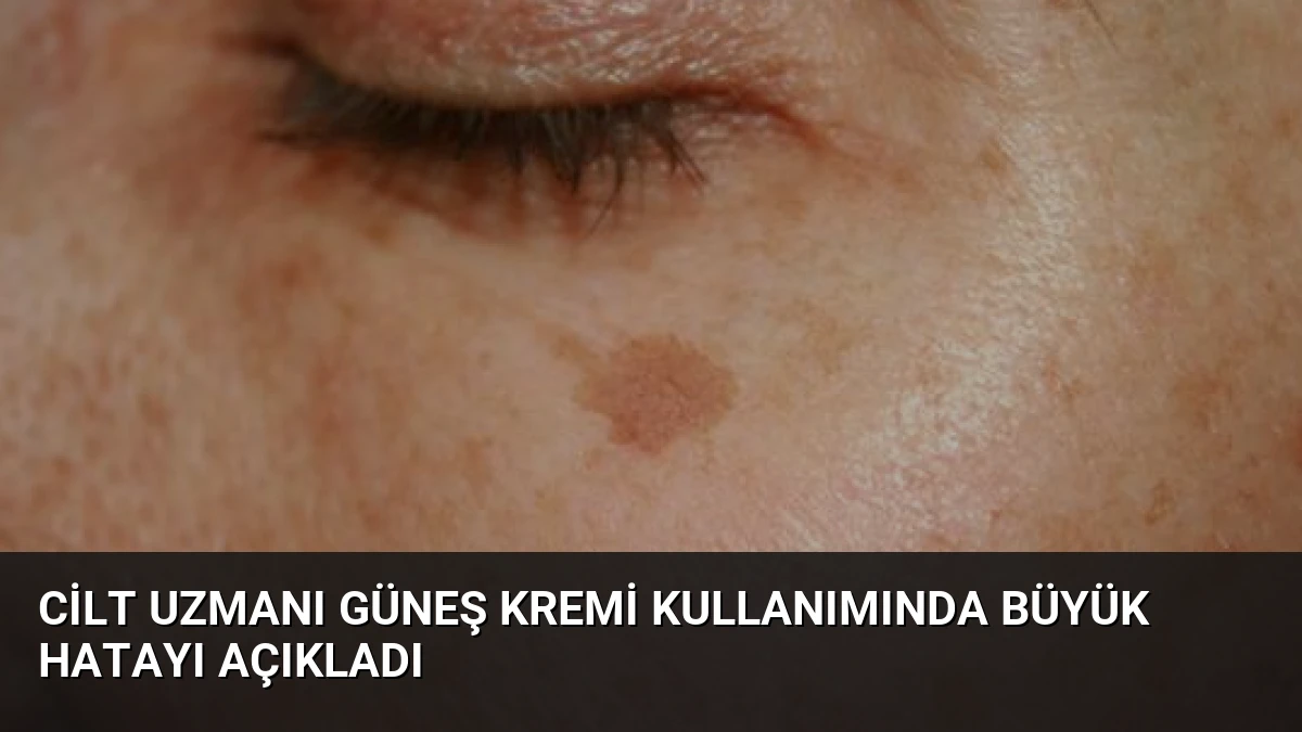 Cilt Uzmanı Güneş Kremi Kullanımında Büyük Hatayı Açıkladı
